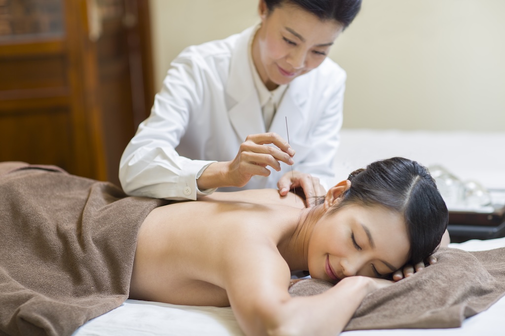 Young woman receiving acupuncture, which we offer at our San Diego mental health and addiction treatment center