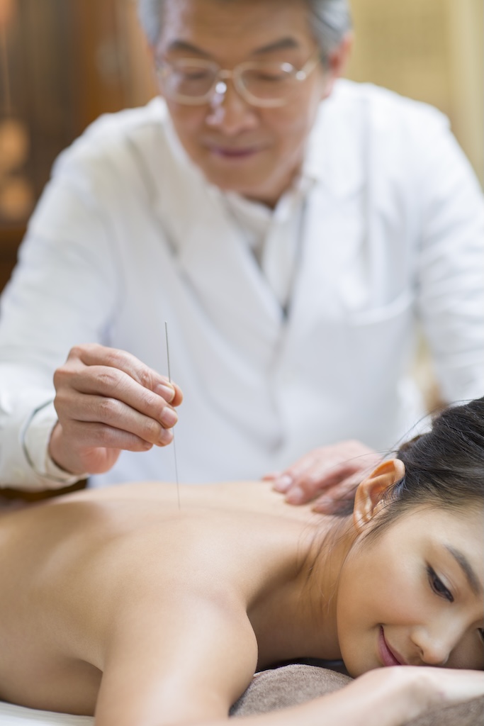 Young woman receiving acupuncture, which we offer at our LGBTQ outpatient treatment center in San Diego