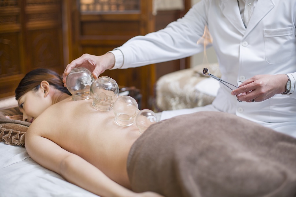 Young woman receiving cupping treatment, which we offer at our outpatient rehab and mental health treatment center for LGBTQ individuals in San Diego